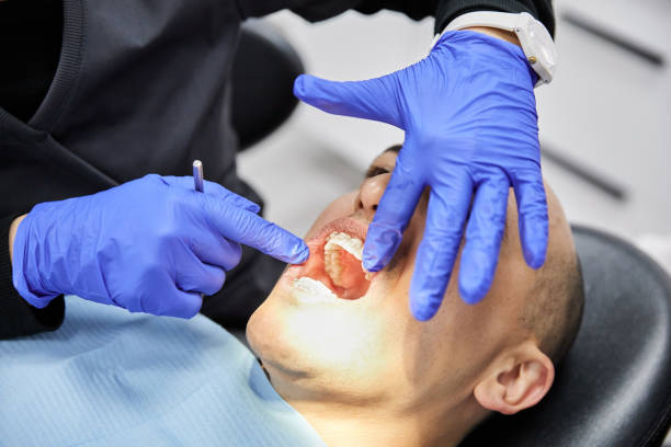 Best Emergency Tooth Extraction in Jamestown, KY