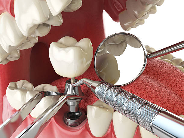 Best After-Hours Emergency Dentist in Jamestown, KY
